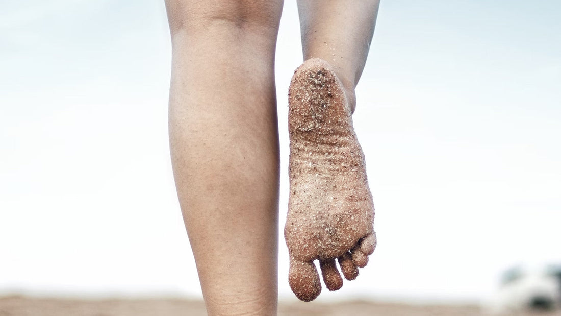 Can You Get Athlete’s Foot on Your Heel?