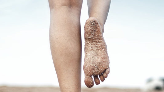 Can You Get Athlete’s Foot on Your Heel?